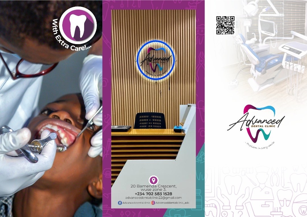 Scaling and Polishing in Abuja – What You Need to Know