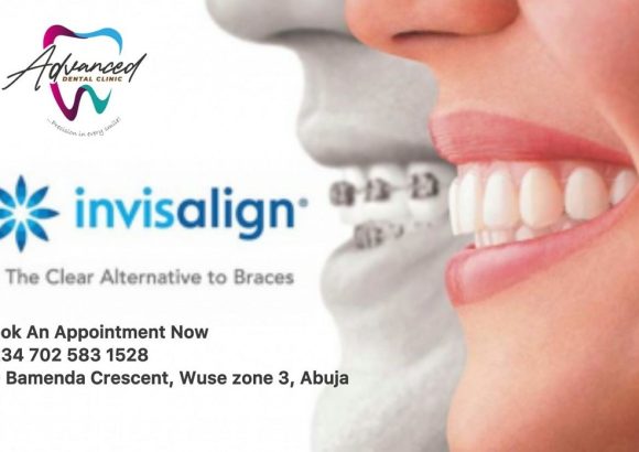 Certified Invisalign Provider in Abuja