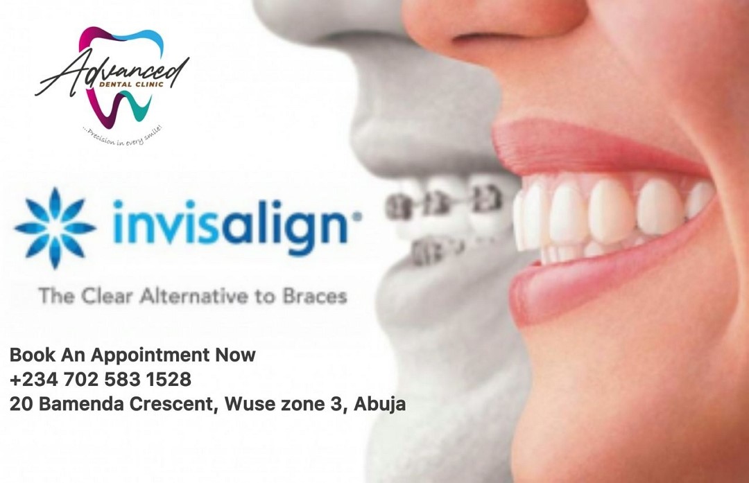 Certified Invisalign Provider in Abuja