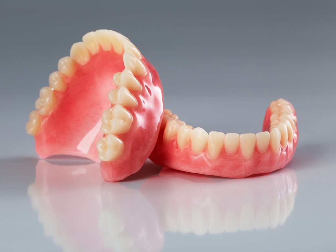 Dental-dentures-in-abuja