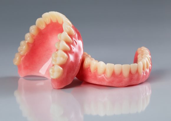 Dental-dentures-in-abuja
